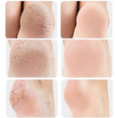 Calcanheira Ortopédica para Fascite Plantar